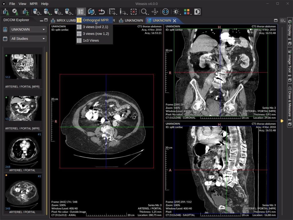 DICOM image viewer online