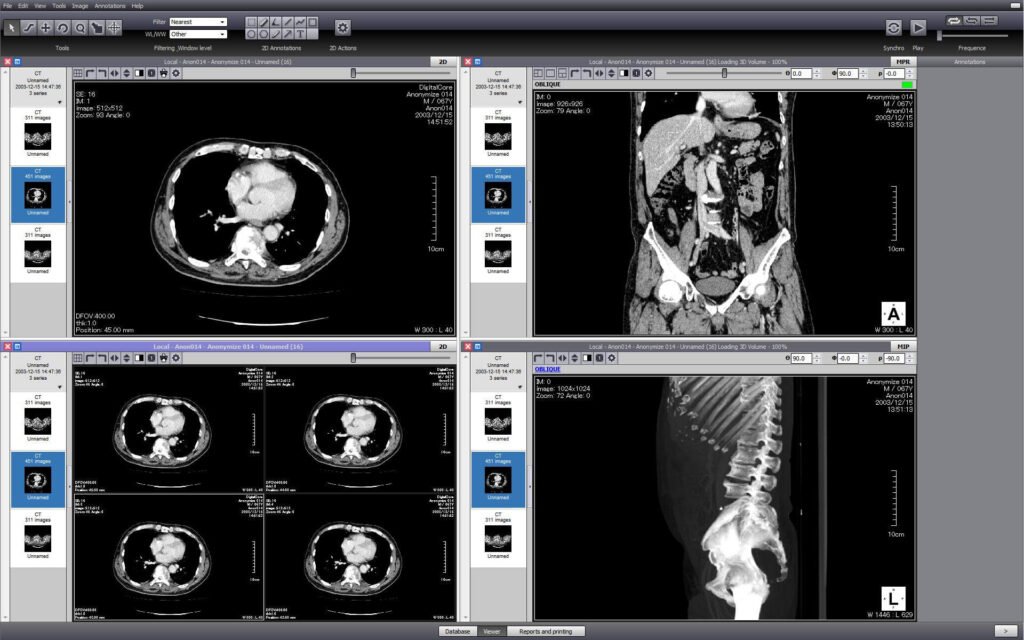 DICOM image viewer online