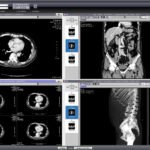 DICOM image viewer online
