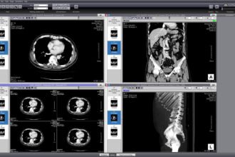 DICOM image viewer online