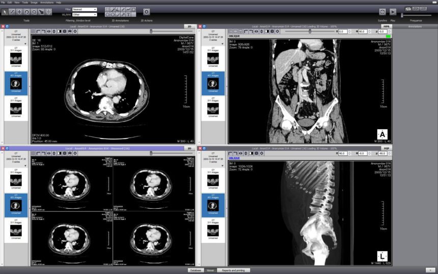 DICOM image viewer online